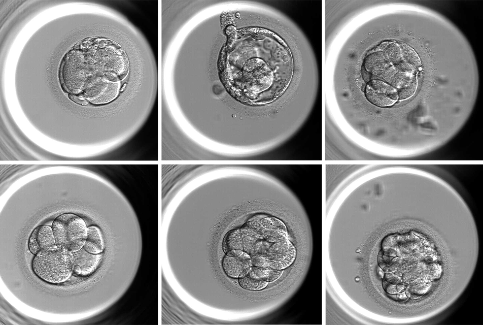 A Fully Automated AI-Based System for Assessing IVF Embryo Quality